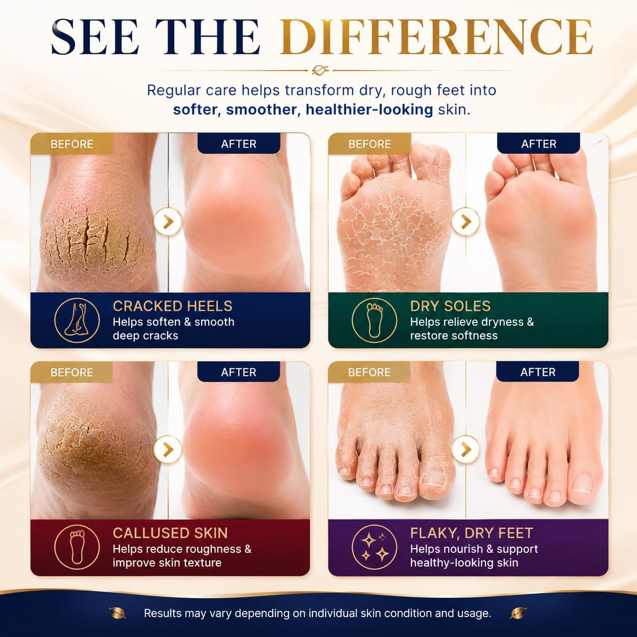 3WB Luxury Gounbal Foot Cream, Intensive Moisturizing Heel Repair Cream for Dry & Cracked Feet, With Propolis & Royal Jelly, Softens Rough Skin, Made in Korea, 110g - View 3 of 5
