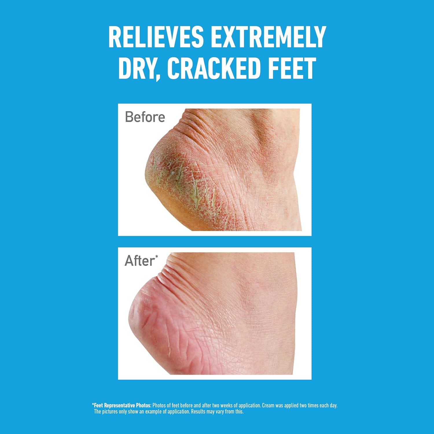 O'Keeffe's Healthy Feet 80ml (2 Pack) - View 5 of 7