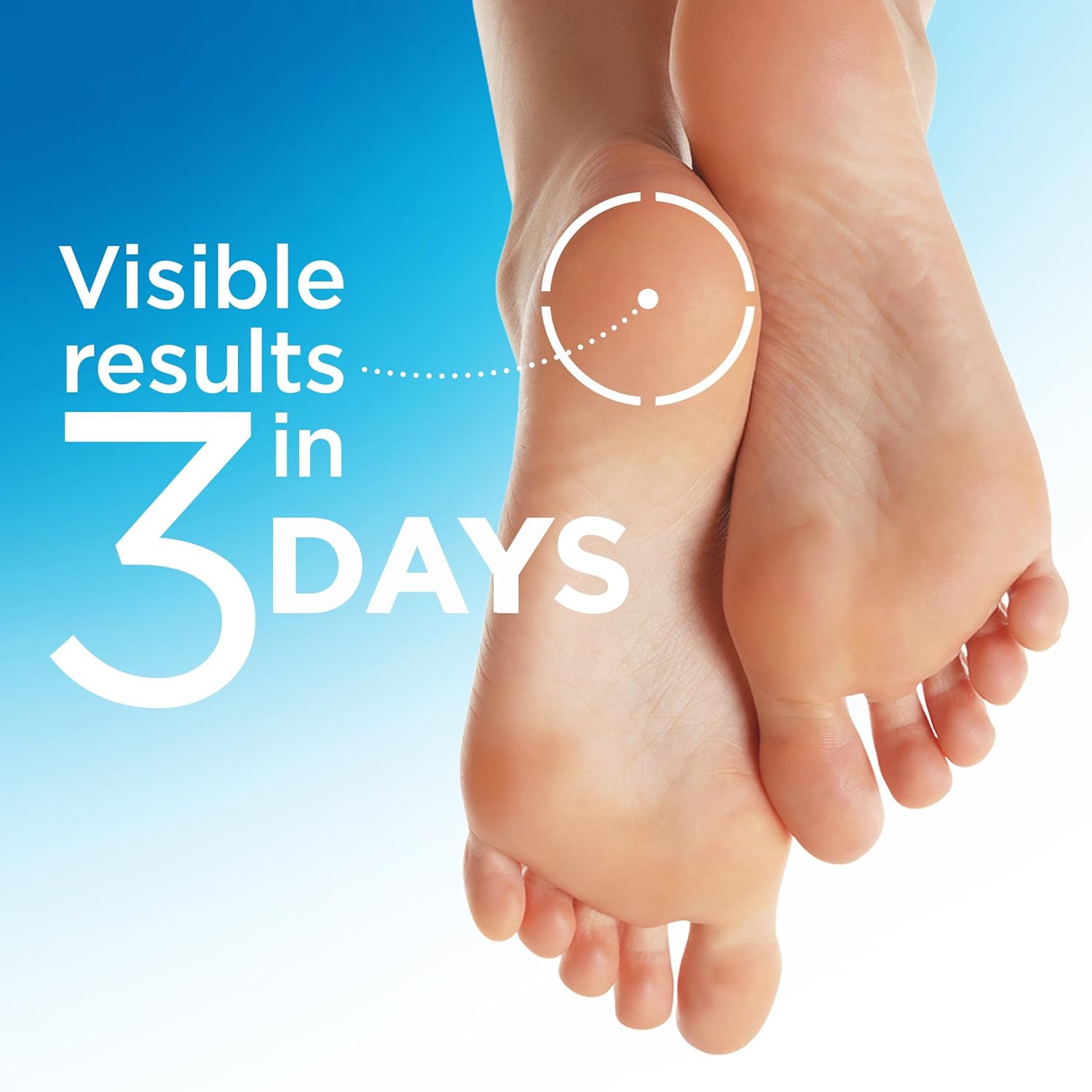 Flexitol Heel Magic For Dry Skin or Rough Heels with Shea Butter & Vitamin E, 2.5 Ounce - View 6 of 6