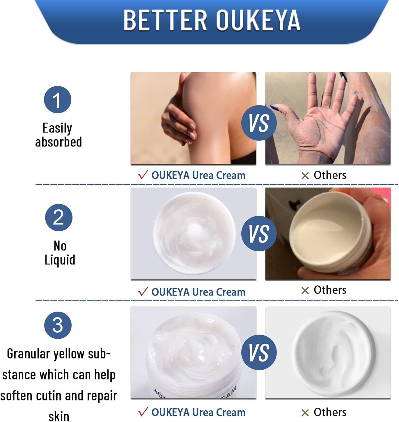 OUKEYA Urea Cream 40 Percent, Urea Foot Cream for Dry Cracked Skin Urea Lotion for Deep Moisturizing, Callus Remover Nourishes Soften, Foot Moisturiser for Women&Men,Maximum Strength 150g (Pack of 2) - View 4 of 5