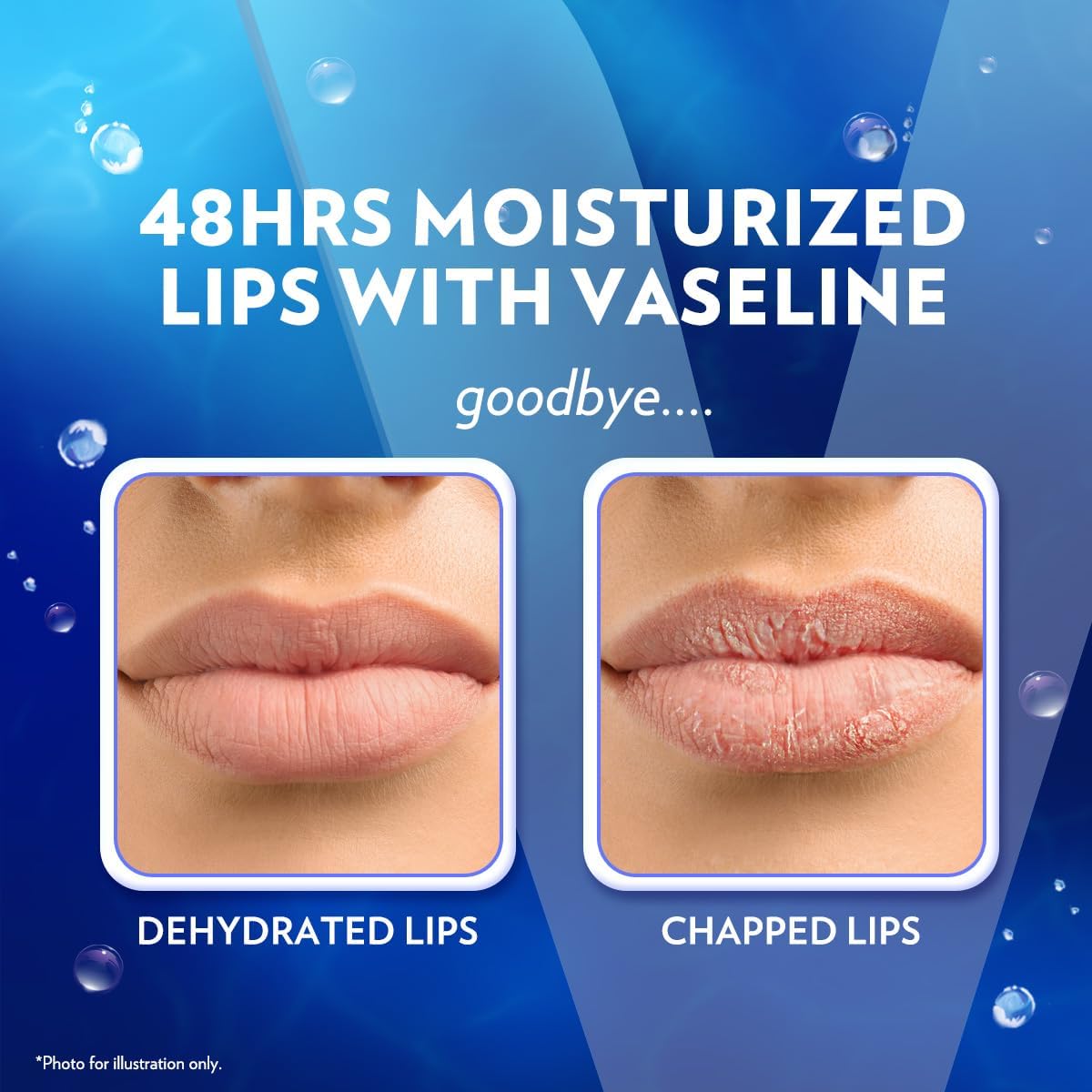 Vaseline Lip Therapy Original Lip Balm With Pure Jelly & Vitamin E For Soft & Glossy Lips | Nourishes & Protects Lips | Non-greasy Lip Moisturizer for Naturally Tinted Lips | 4.8 gm - View 2 of 6