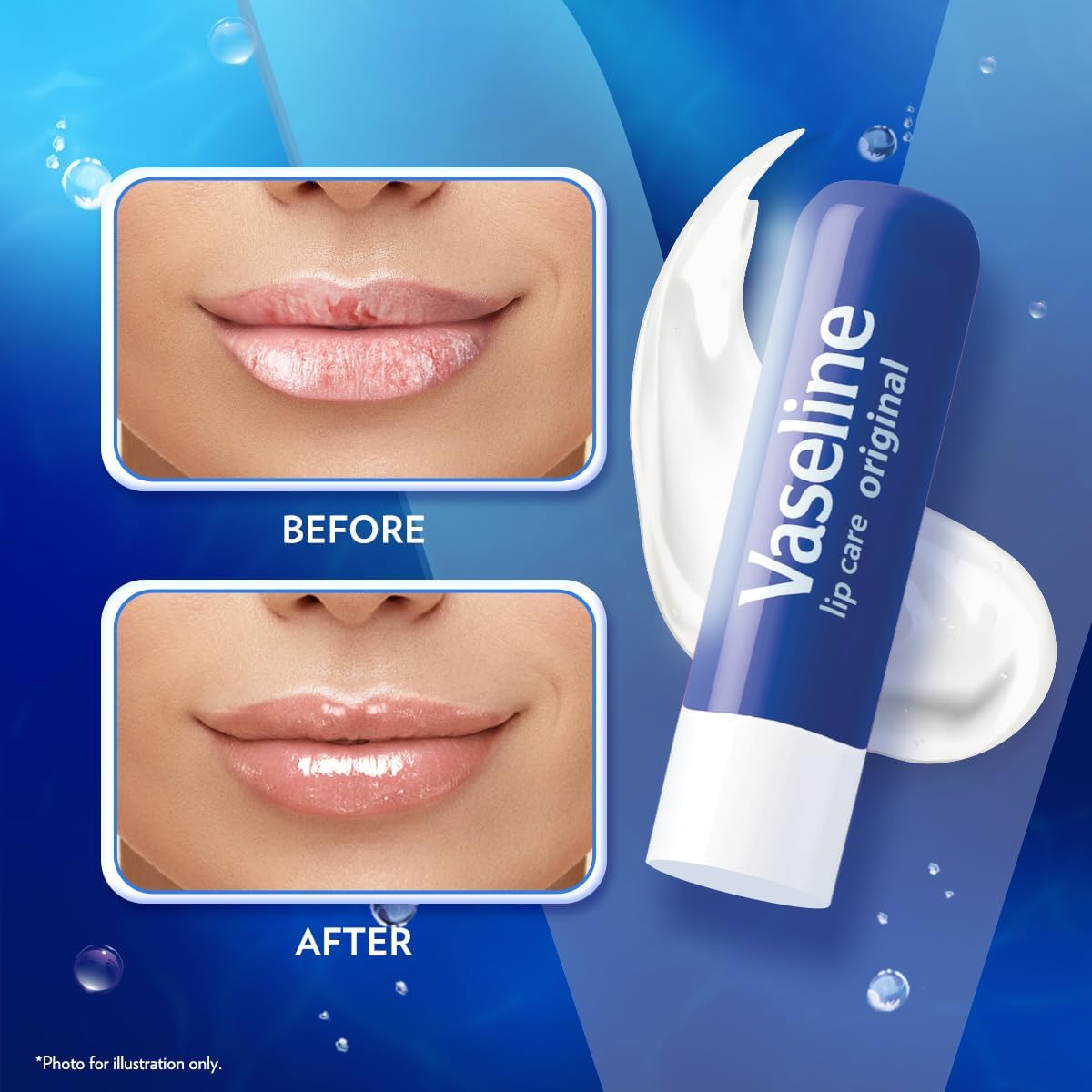 Vaseline Lip Therapy Original Lip Balm With Pure Jelly & Vitamin E For Soft & Glossy Lips | Nourishes & Protects Lips | Non-greasy Lip Moisturizer for Naturally Tinted Lips | 4.8 gm - View 5 of 6