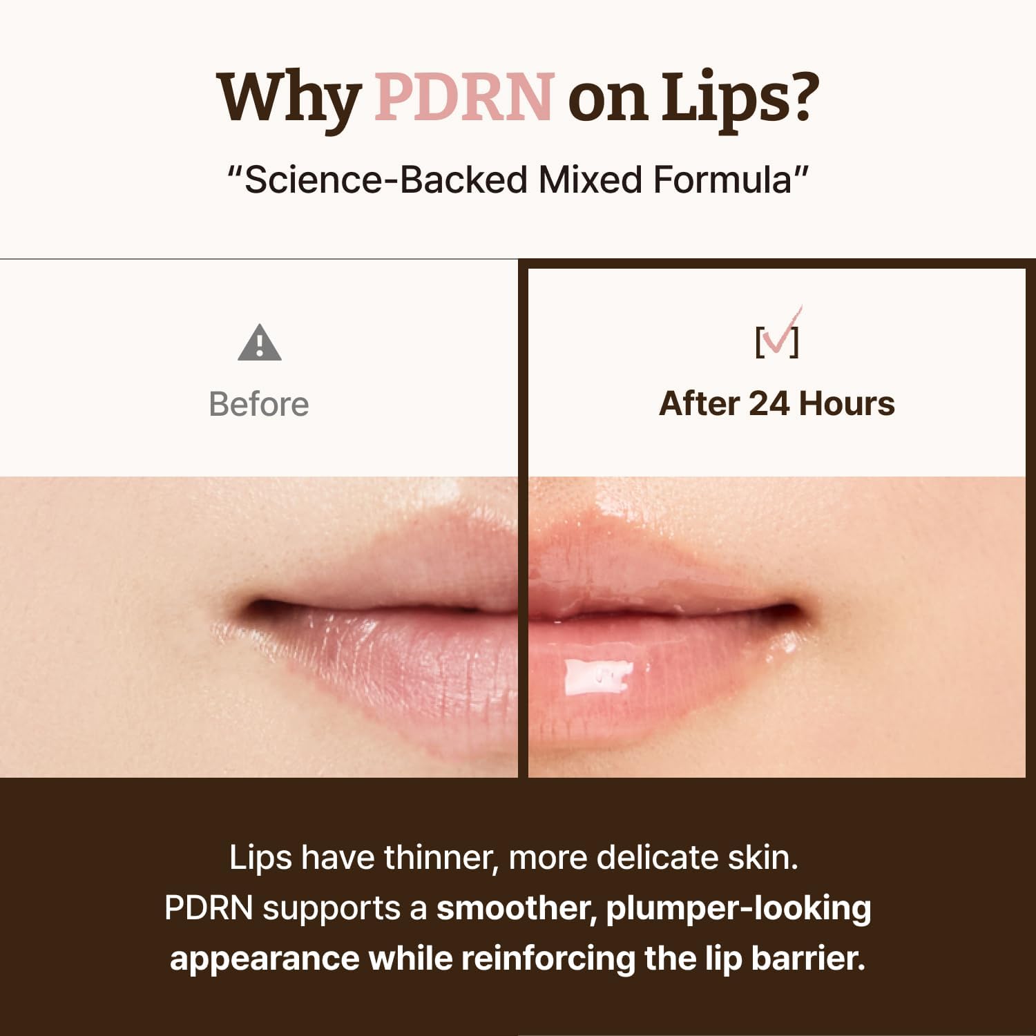 Dr.Reju-All Advanced PDRN Rejuvenating Lip Serum - Hydrating Lip Balm with Lipozip PDRN for Glowy, Dewy Lips - Gentle Exfoliating & Smoothing Lip Moisturizer - Hibiscus & Lactic Acid - 10ml - View 5 of 6