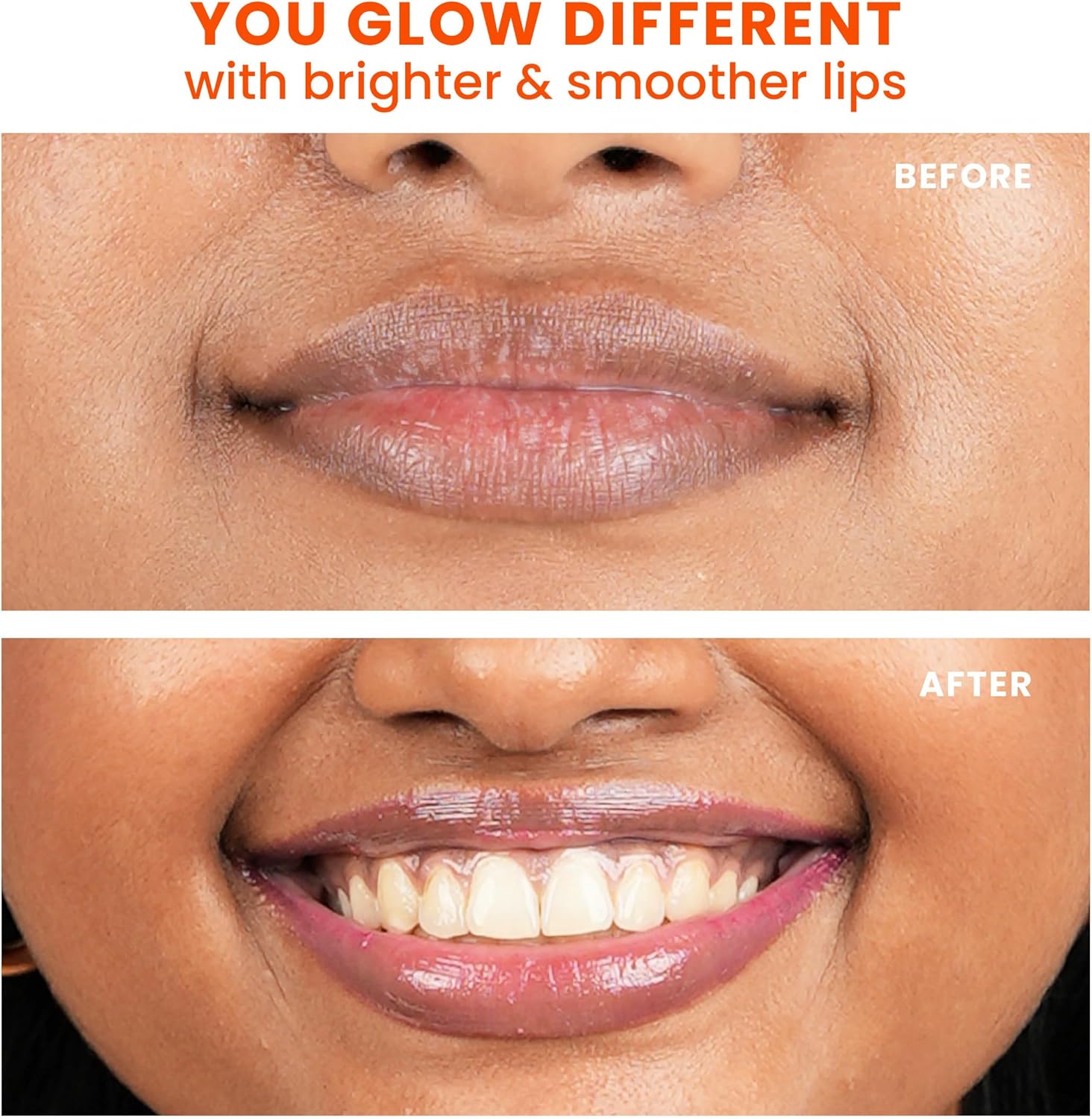 Foxtale SPF 30 Brightening Lip Balm for Dark Lips with Peptides & Vitamin C | Brightens | Hydrates | Tinted Lip Balm - Light Mauve Glaze 12gm - View 2 of 6