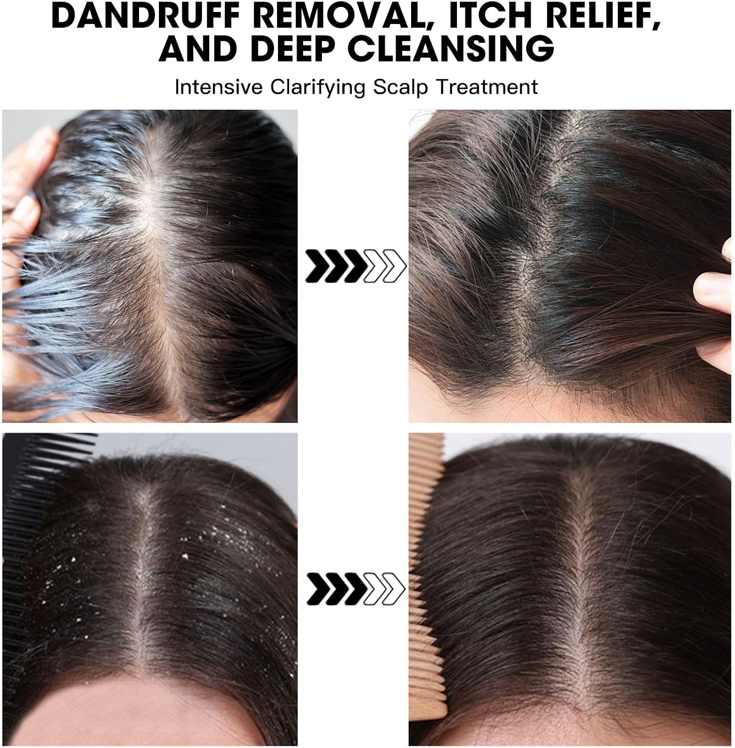 Dead Sea Salt Scalp Scrub 280g - Exfoliator for Oily Scalp, Itchy Scalp & Dandruff Relief - Clarifying Hair Treatment with Herbal Essences for Scalp Build-Up, Flakes & Hair Growth - View 2 of 7