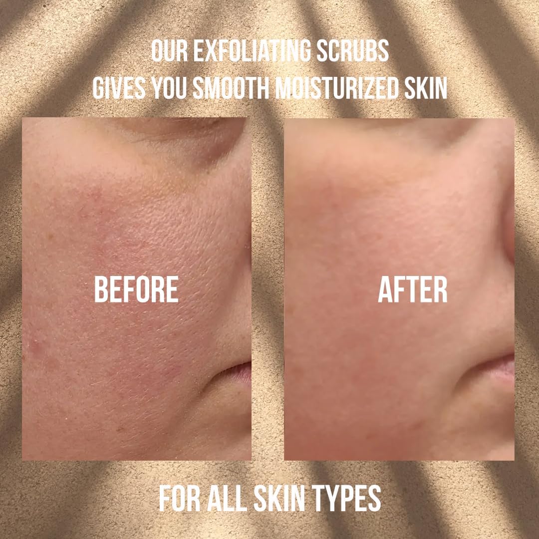Arabica Coffee Scrub, Moisturizing Exfoliating Face, Body Foot, Hand, Natural Exfoliating for Smooth Skin, Organic Scrub Fights Stretch Marks, Appearance Cellulite, Fine Lines & Wrinkles - View 5 of 7