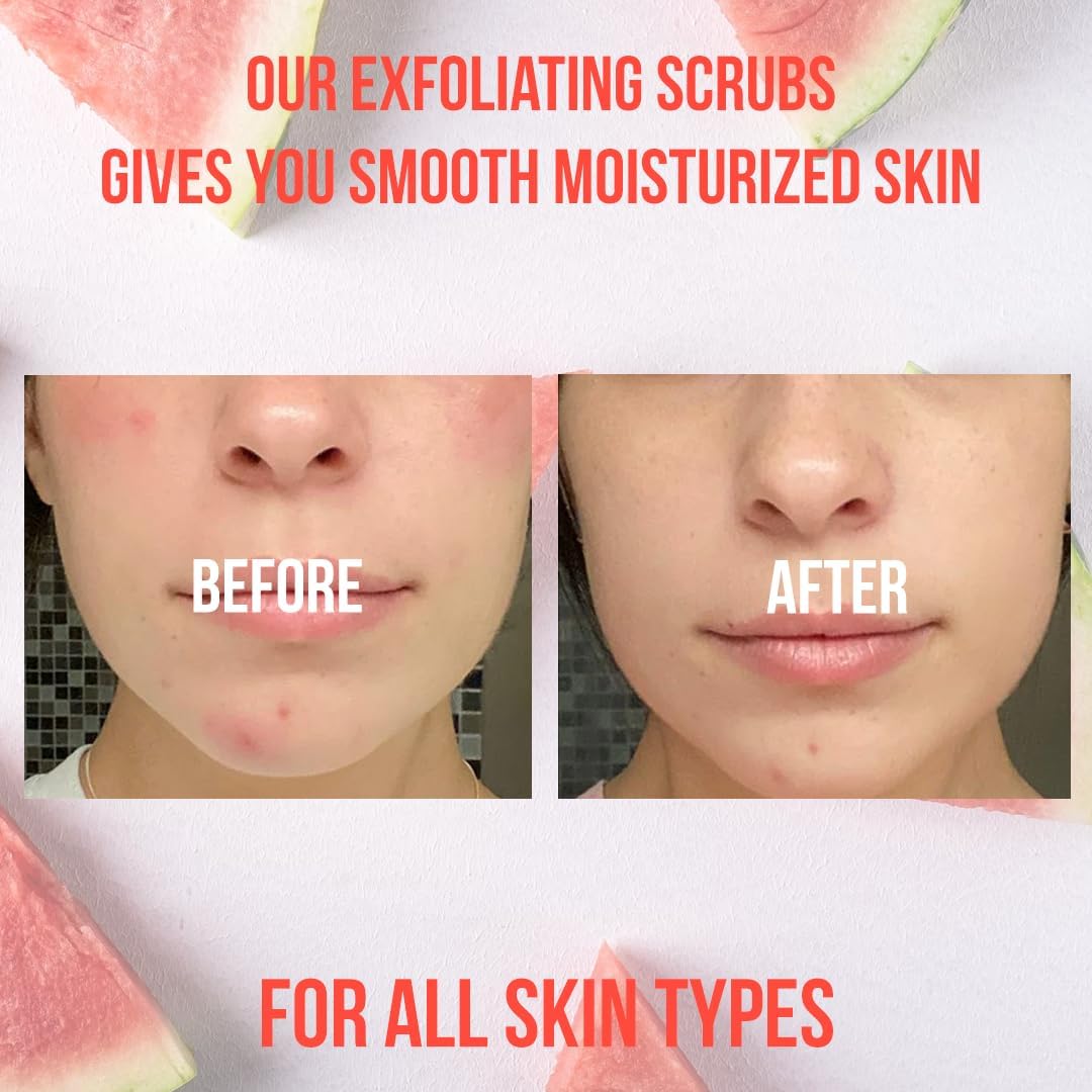 Watermelon Scrub, Exfoliating Bath Body Scrub, Gently Exfoliating Face Scrub for Women with Dead Sea Salt, Shea Butter, Vitamin E and Organic Oils, Cleansing and Nourishing Properties, 10 oz - View 5 of 6