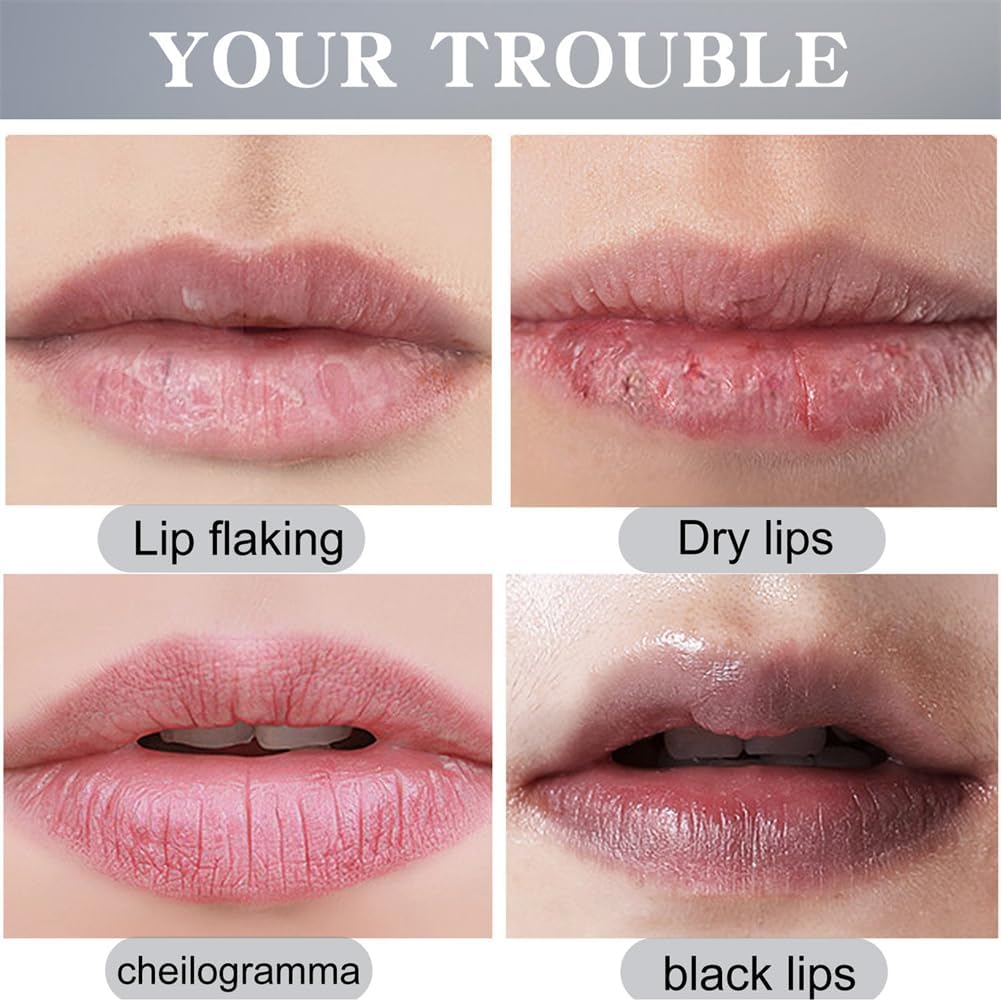 Turmeric Lip Balm, Lip Whitening Products for Dark Lips Repair Treatment Cream, Lip Softening Moisturizing Exfoliator (2 PCS) - View 6 of 6
