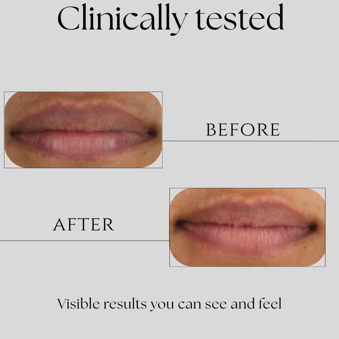 Lip Ritual Lip Serum Gloss | Depigmenting, Hydrating & Plumping with Peptides, Niacinamide, & Vitamin C | Brightens Dark Lips & Evens Lip Tone | Clinically Proven for Dry, Chapped, Cracked & Pigmented Lips | 8ml - View 2 of 8