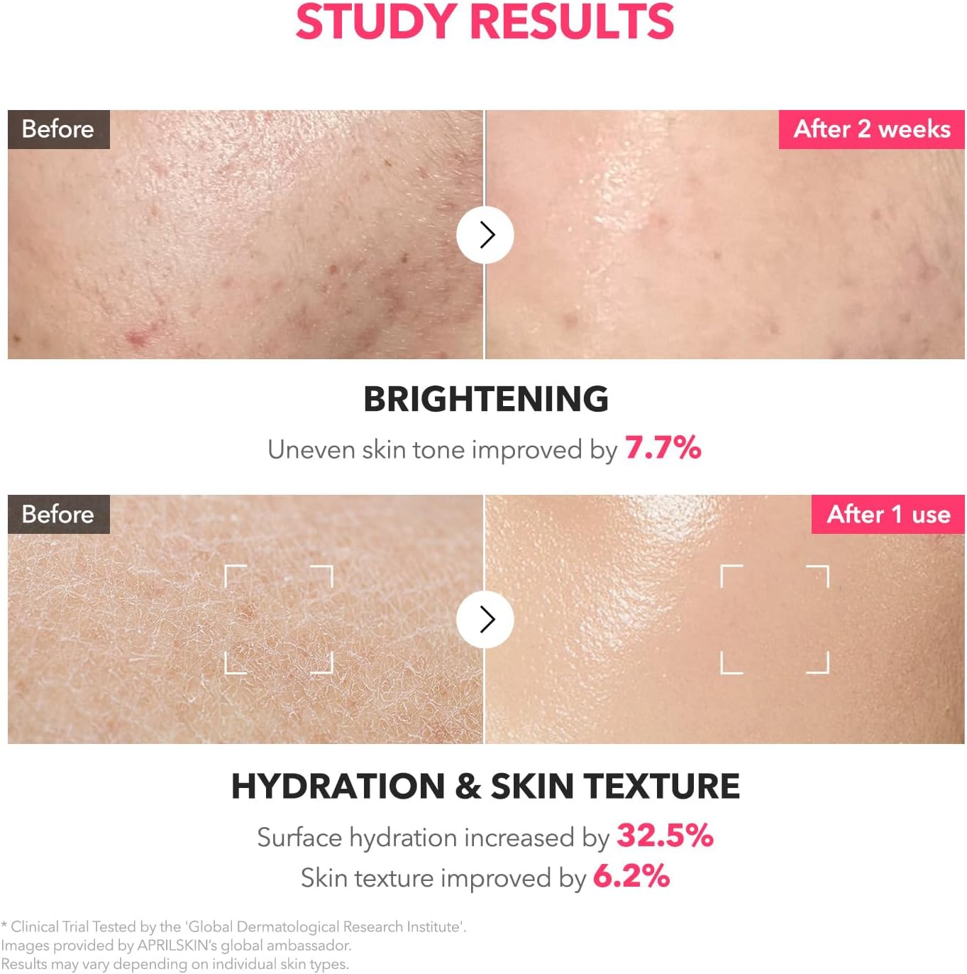 APRILSKIN TXA+Niacinamide 99 Pink Milky Toner | 99% High-Purity TXA 3%+ Niacinamide 5% | Highly Concentrated Cream Toner | Deep Moisturizing Formula for Dull Skin | 5.07 fl.oz. - View 3 of 6